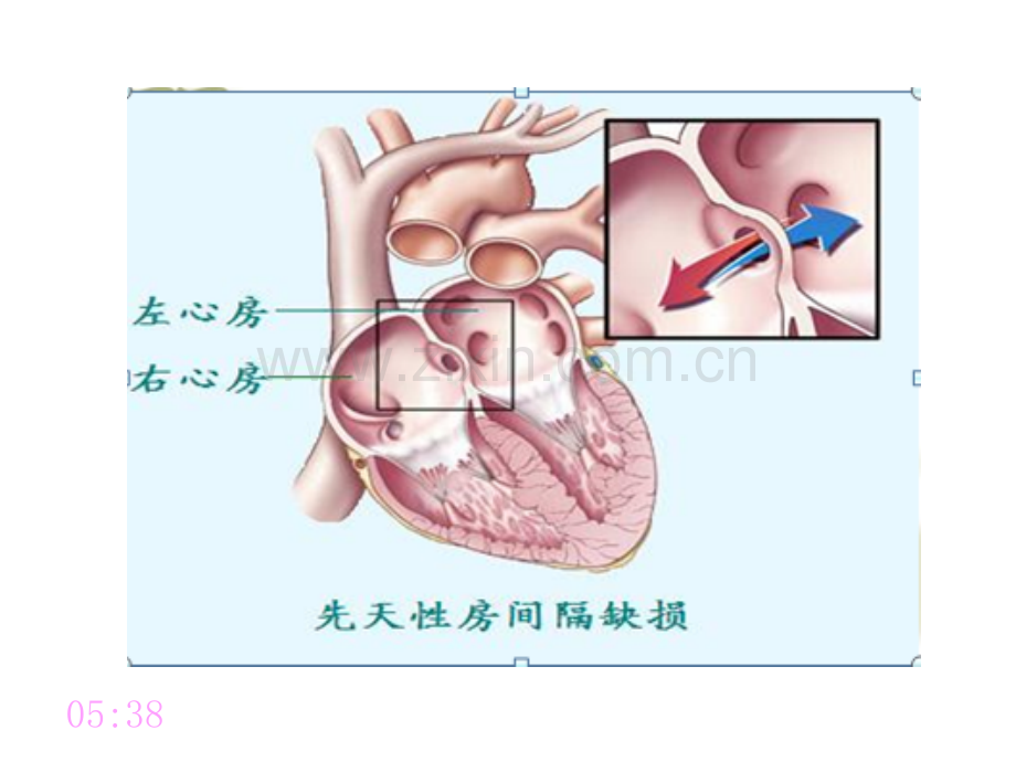 常见重要脏器疾病.pptx_第3页