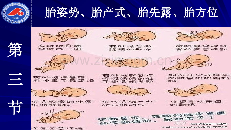 第三节胎姿势、胎产式、胎先露、胎方位.ppt_第2页