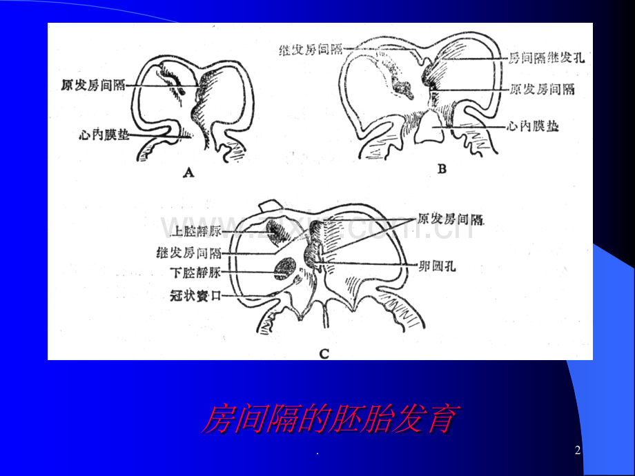 房缺自主学习---刘闯.ppt_第2页