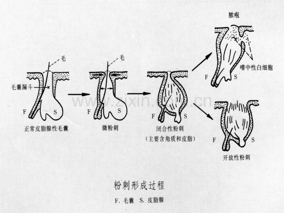 皮肤附属器与色素性疾病PPT医学.ppt_第2页