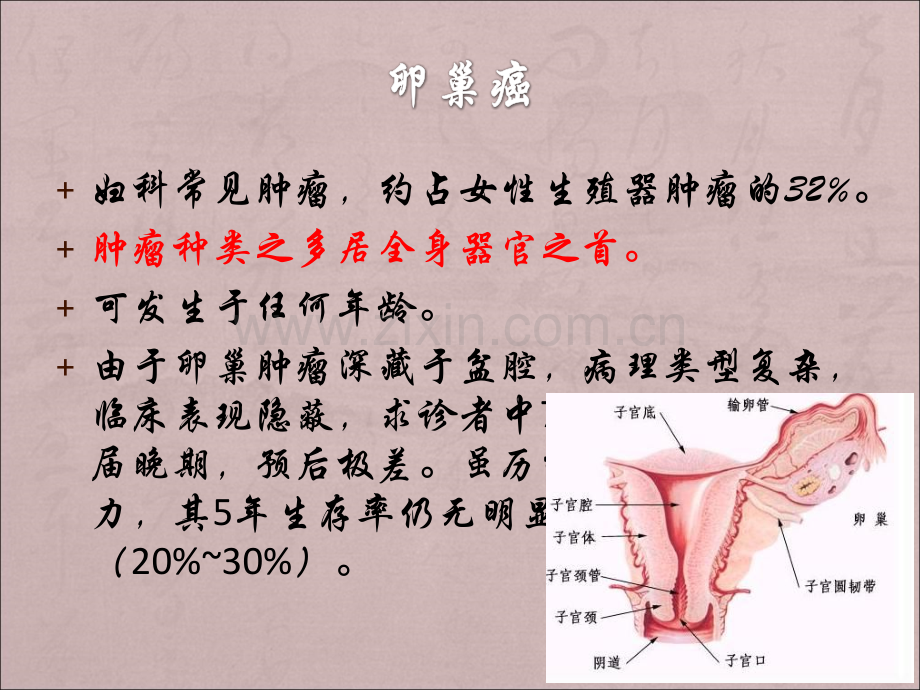 卵巢癌的中西医结合诊断与治疗.ppt_第2页