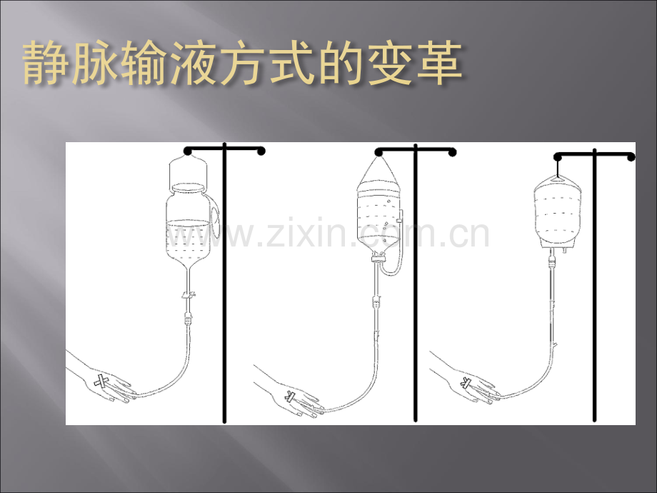 静脉输液安全.ppt_第3页