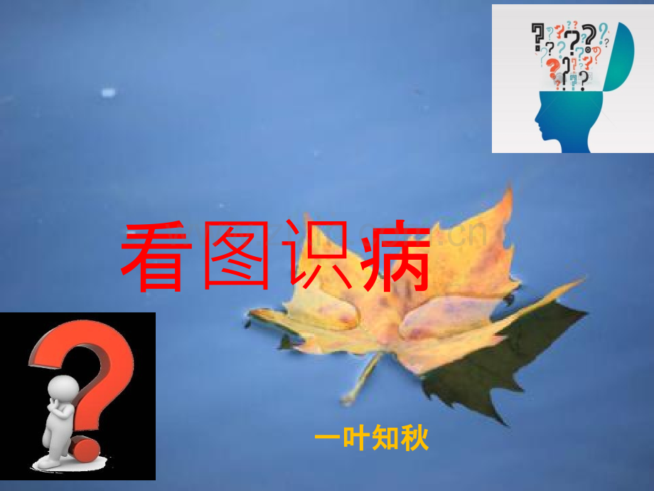 儿童常见传染病的防治知识.ppt_第2页