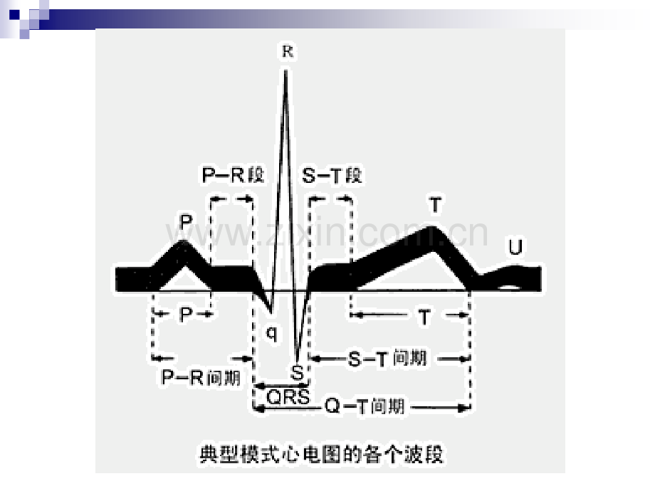 6.4心律失常及护理(第二次)医学PPT课件.ppt_第3页