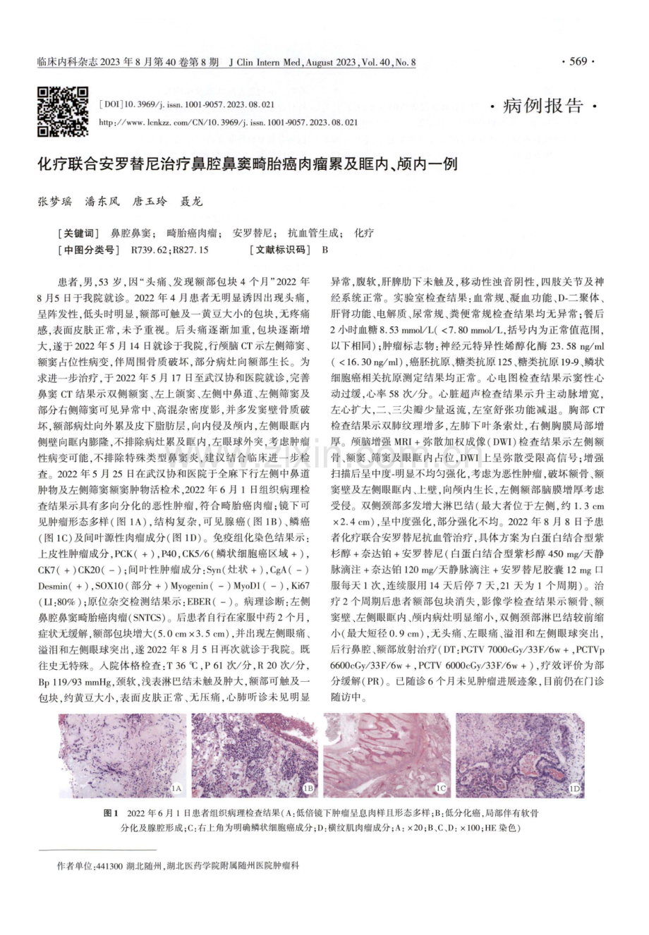 化疗联合安罗替尼治疗鼻腔鼻窦畸胎癌肉瘤累及眶内、颅内一例.pdf_第1页