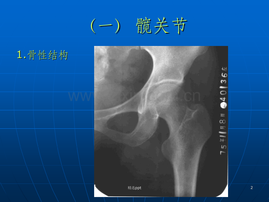 髋关节及股部解剖.ppt_第2页