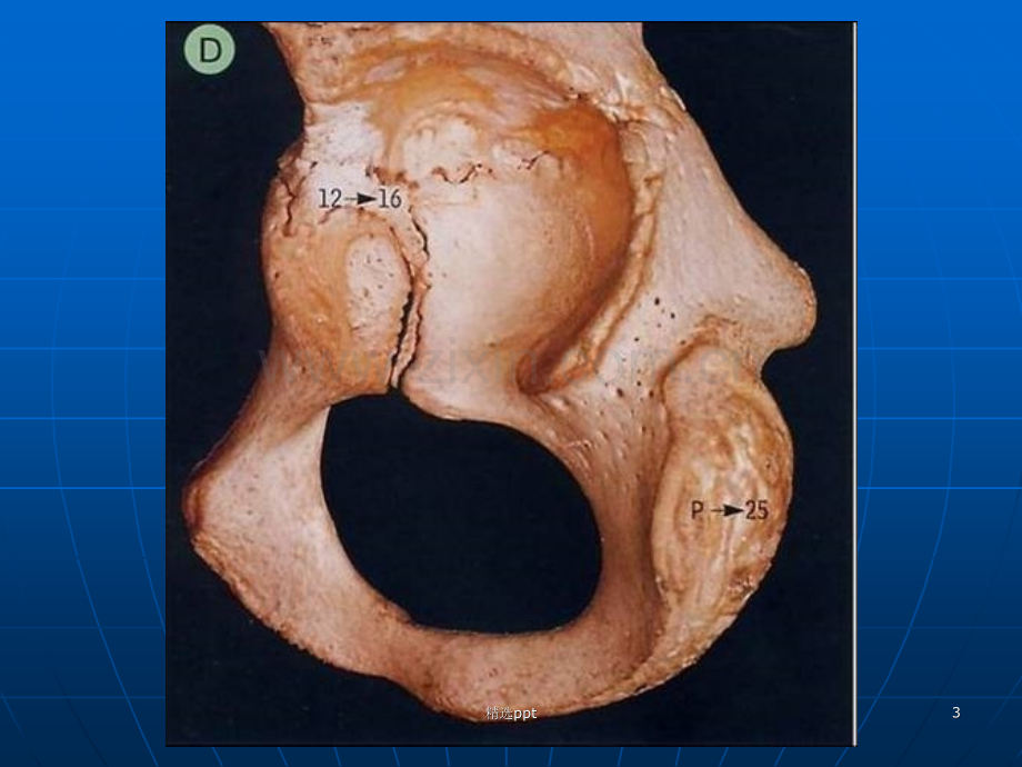 髋关节及股部解剖.ppt_第3页