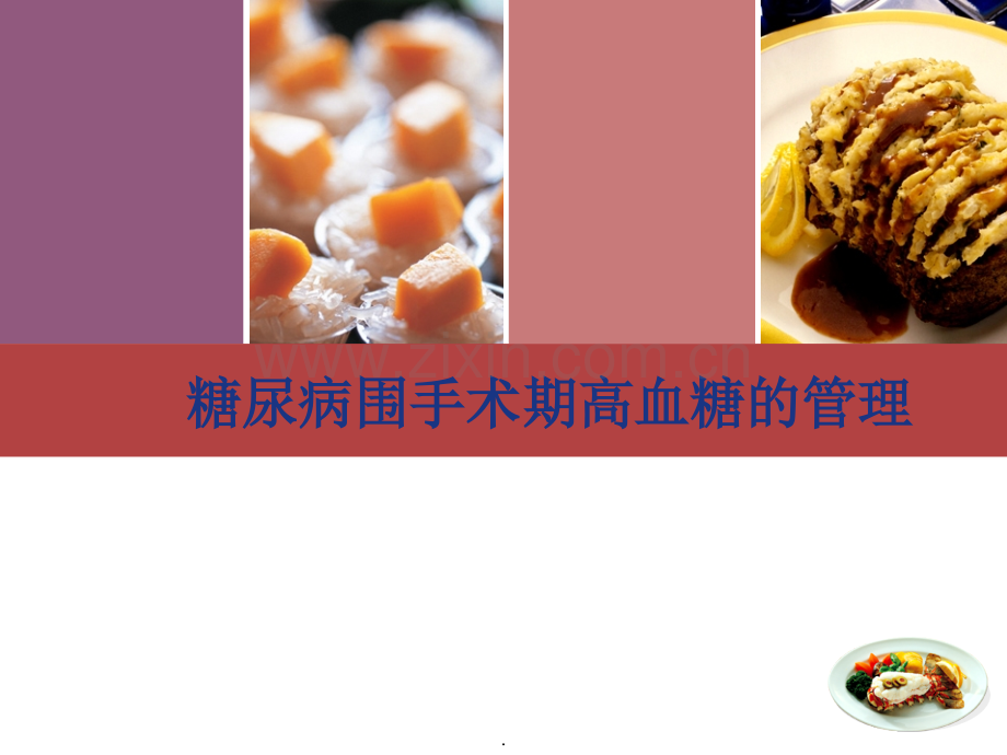 围手术期血糖的管理.ppt_第1页