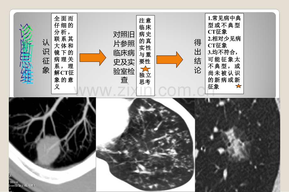 肺特殊CT征象本.ppt_第3页