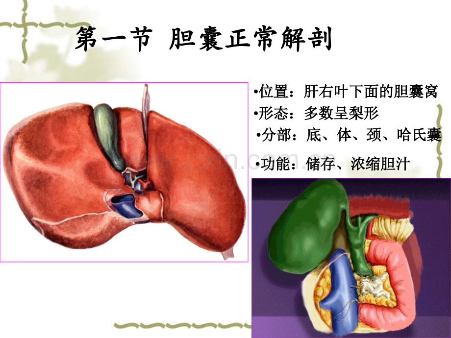 3胆囊超声诊断医学PPT课件.ppt_第2页