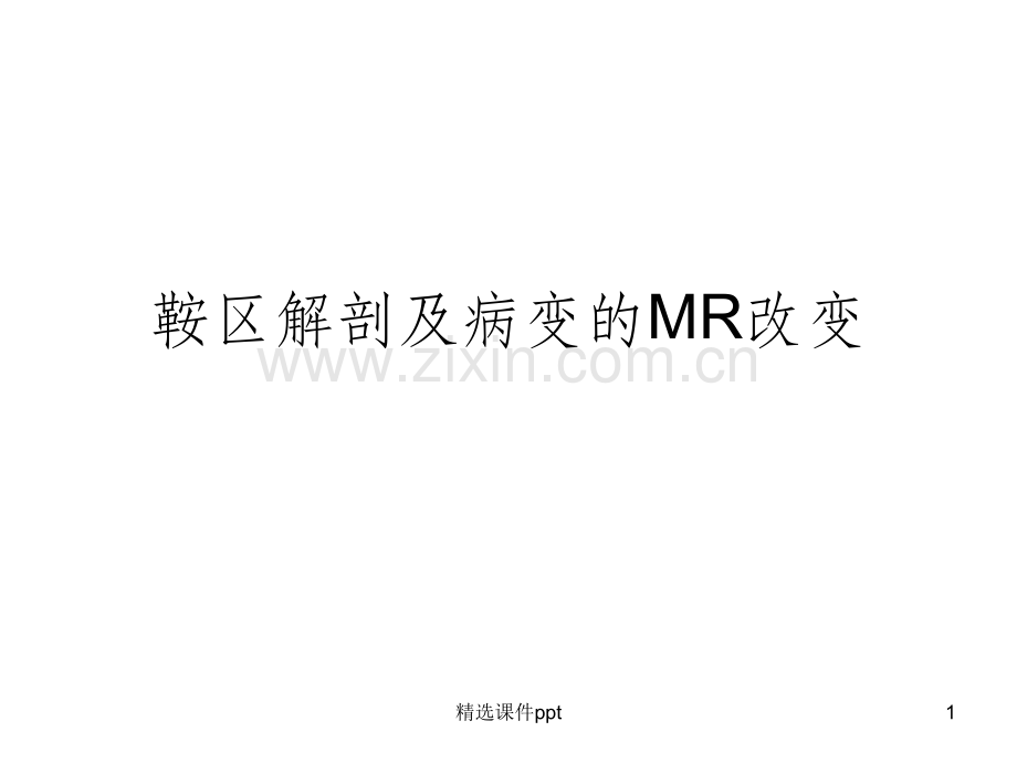 鞍区解剖及病变的MR改变.ppt_第1页