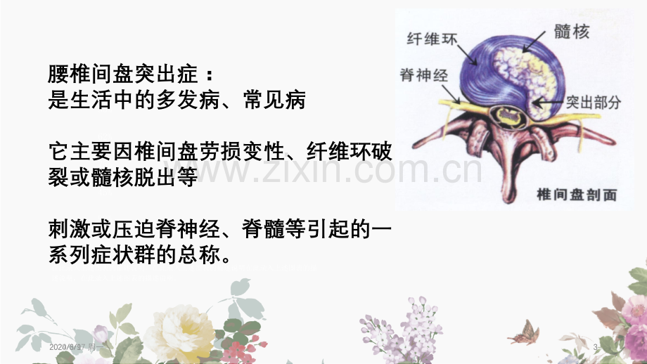 腰椎间盘突出健康教育幻灯片.ppt_第3页