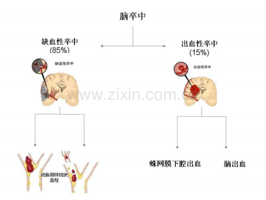 溶栓相关试验及进展.pptx_第2页