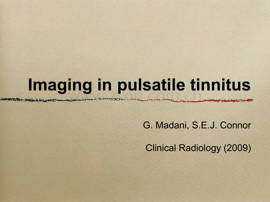 搏动性耳鸣的影像表现.pptx_第1页