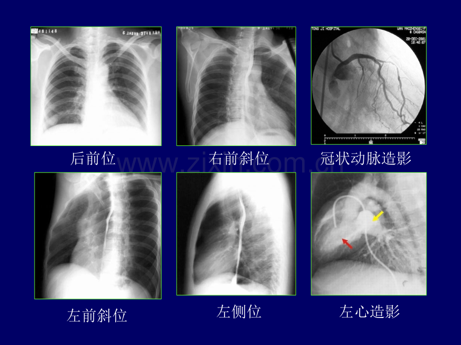 循环系统影像诊断教学.pptx_第3页