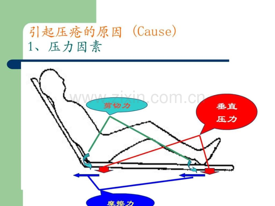 压疮的预防与护理1.pptx_第3页