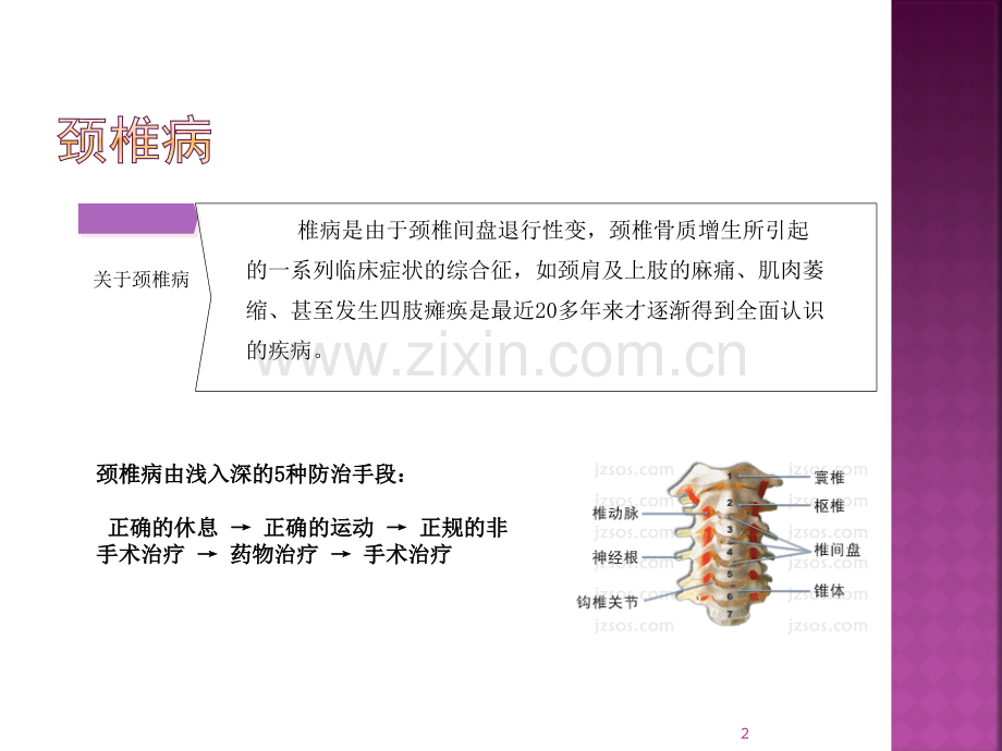 常见肌肉关节疼痛疾病预防保健.pptx_第2页