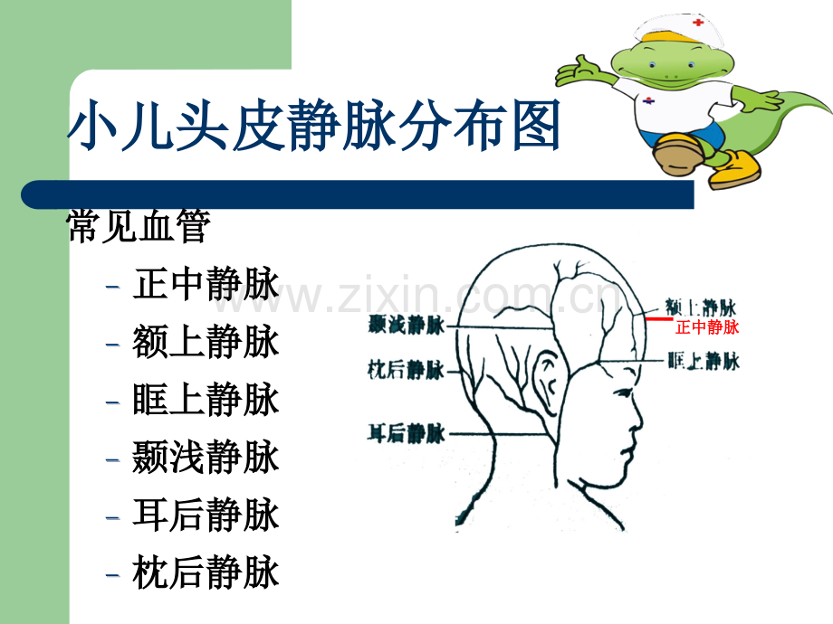 小儿头皮静脉穿刺.pptx_第3页