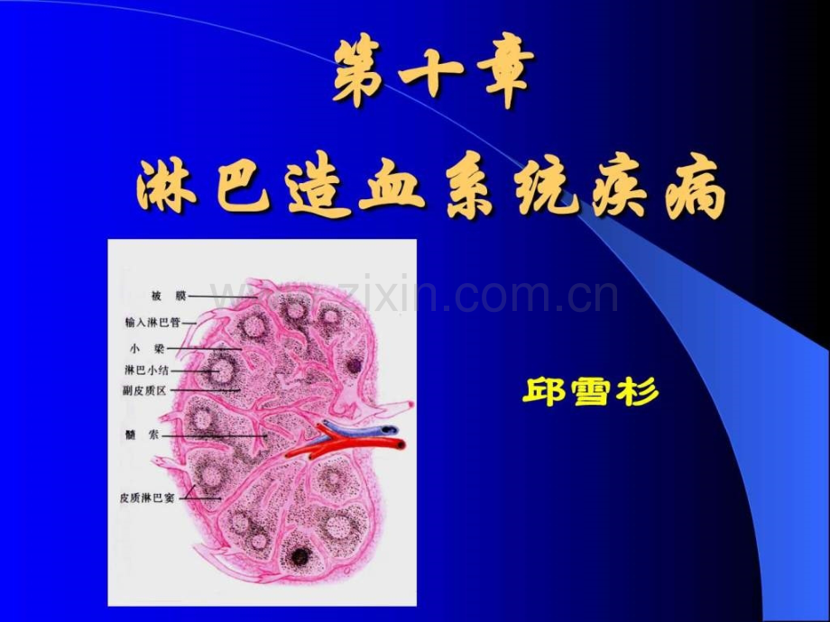 淋巴造血系统疾病3.pptx_第1页