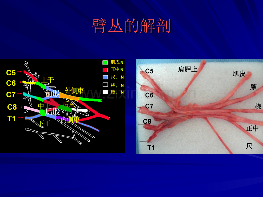 臂丛损伤的常用手术方式和护理探讨护理讲课.pptx_第2页