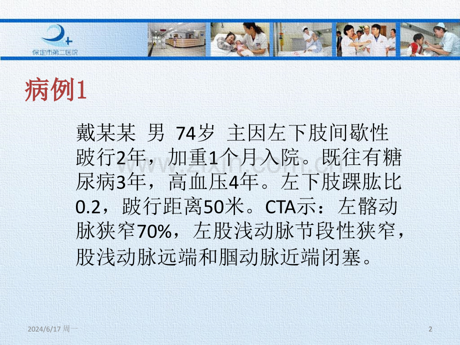 下肢动脉硬化闭塞症的腔内治疗.ppt_第2页