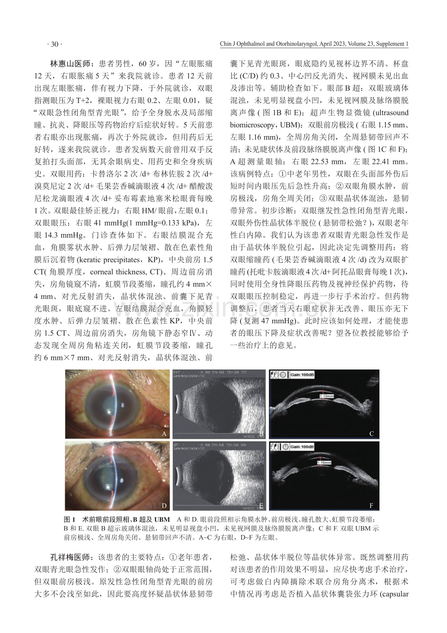 急性闭角型青光眼1例.pdf_第2页