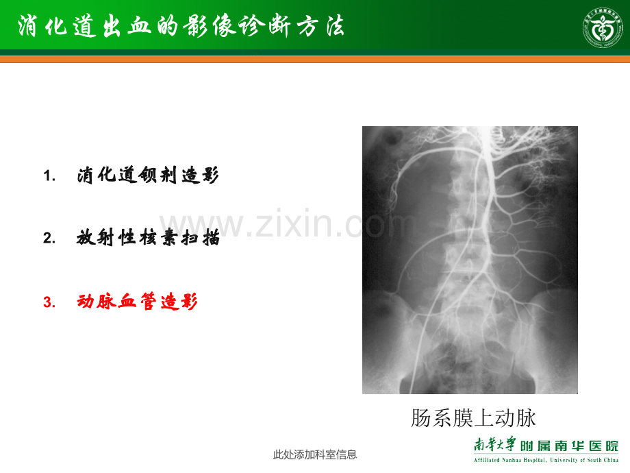 消化道出血的影象诊断和介入治疗幻灯片.ppt_第3页