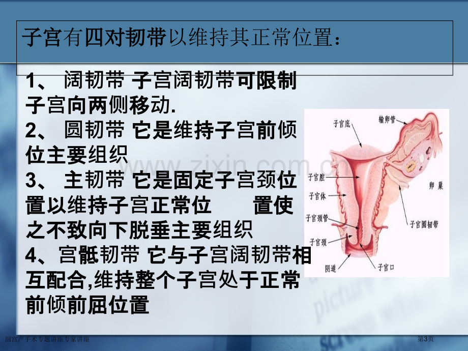 剖宫产手术专题讲座专家讲座.pptx_第3页