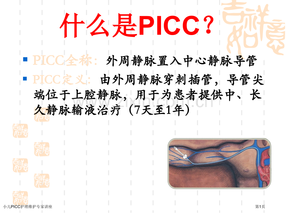 小儿PICC护理维护专家讲座.pptx_第1页