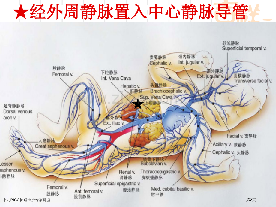 小儿PICC护理维护专家讲座.pptx_第2页