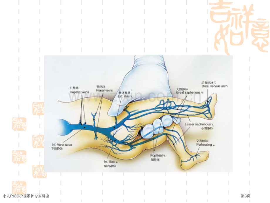 小儿PICC护理维护专家讲座.pptx_第3页