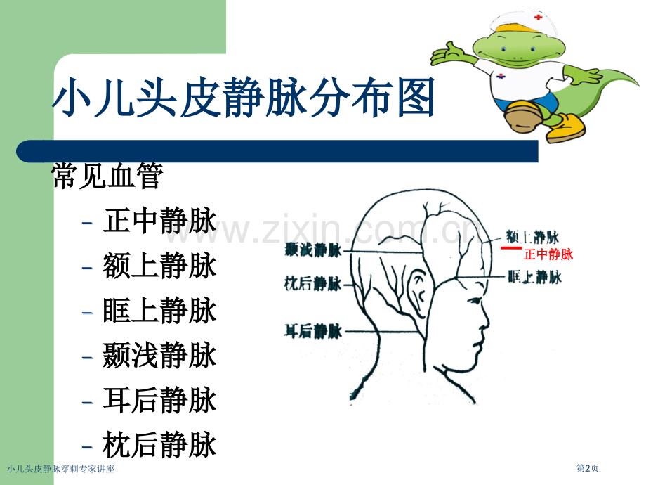 小儿头皮静脉穿刺专家讲座.pptx_第2页