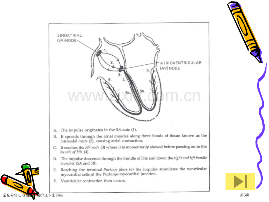 常见异常心电图的识别护理专家讲座.pptx_第3页