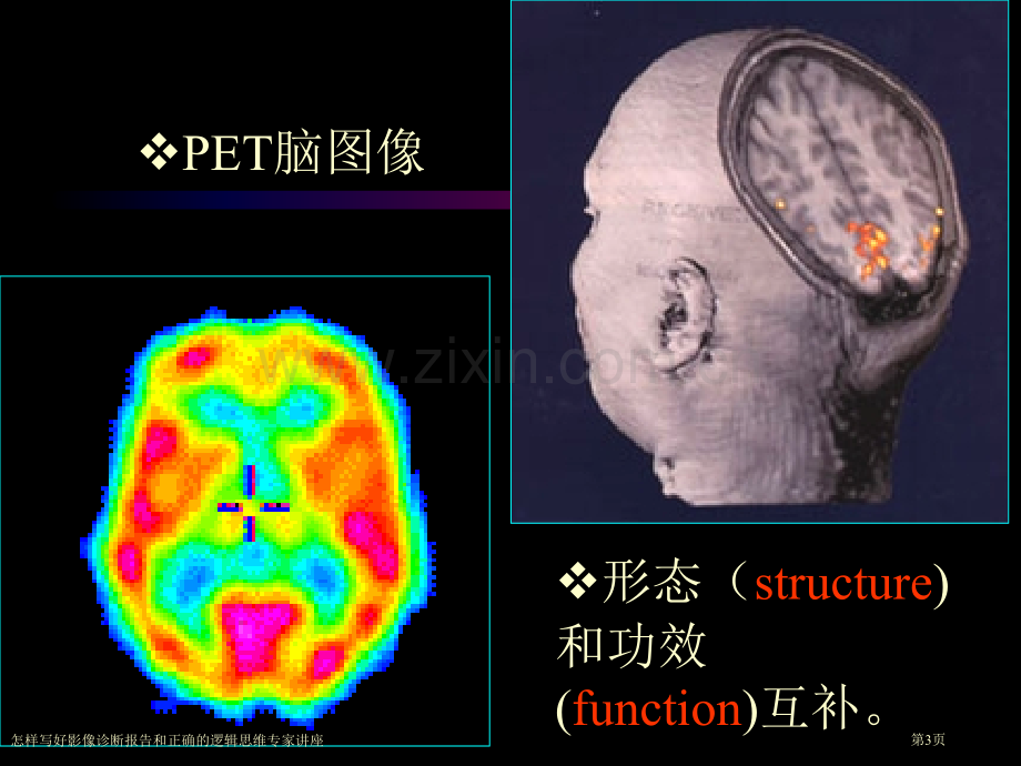 怎样写好影像诊断报告和正确的逻辑思维专家讲座.pptx_第3页