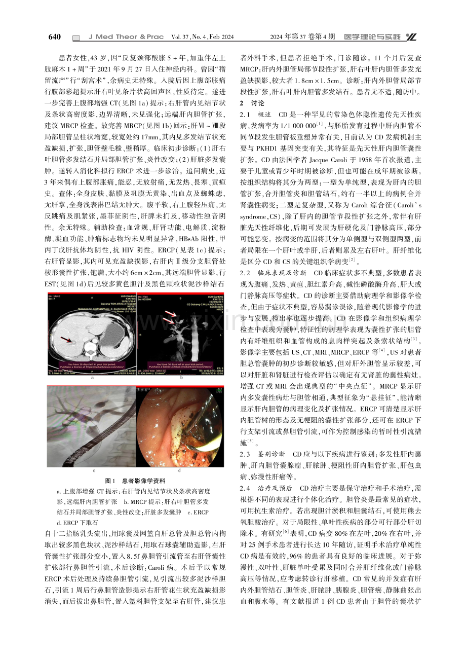 Caroli病1例及文献回顾.pdf_第2页