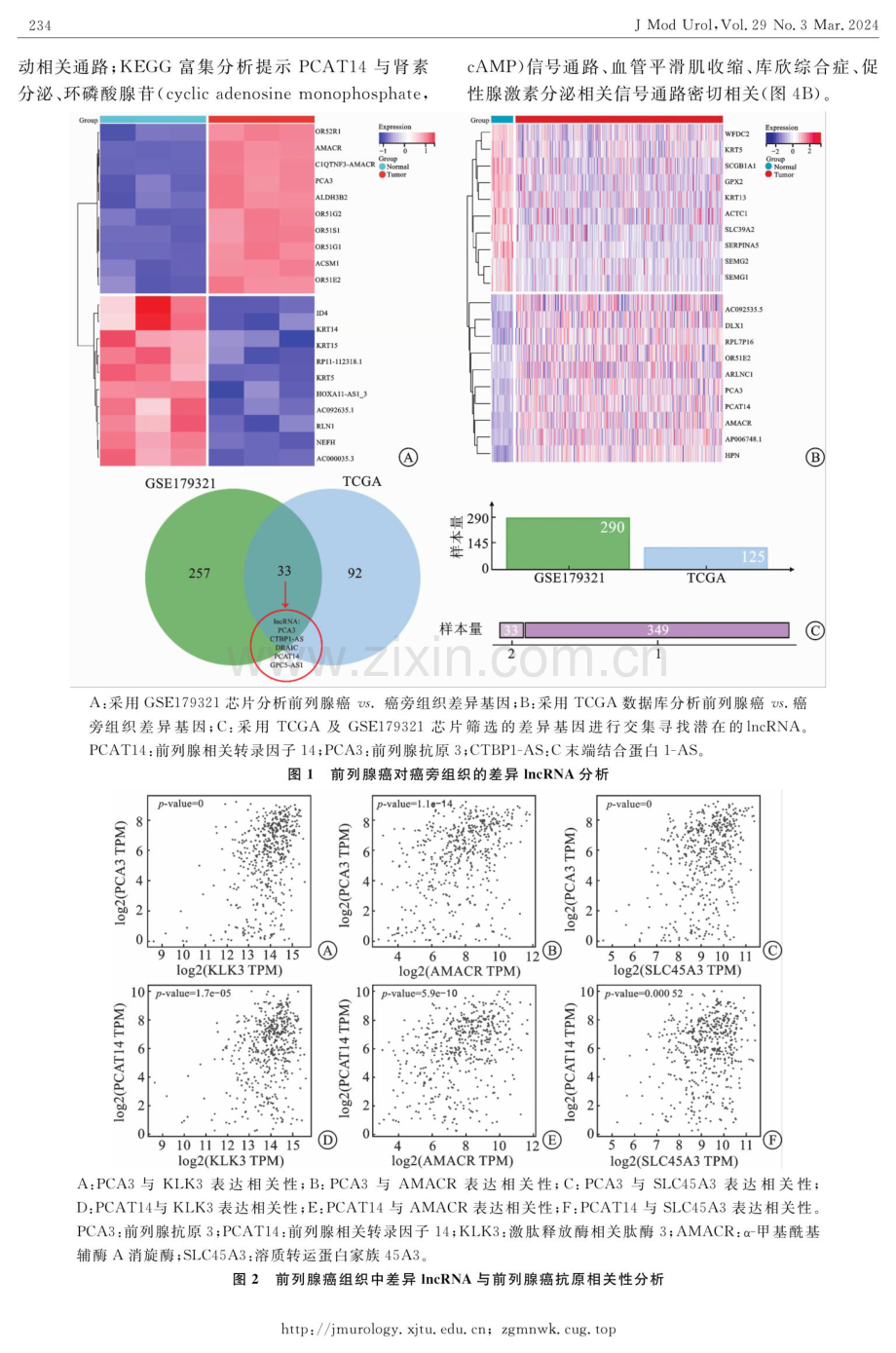 基于生物信息数据库分析前列腺癌组织特异性lncRNA表达及临床意义.pdf_第3页