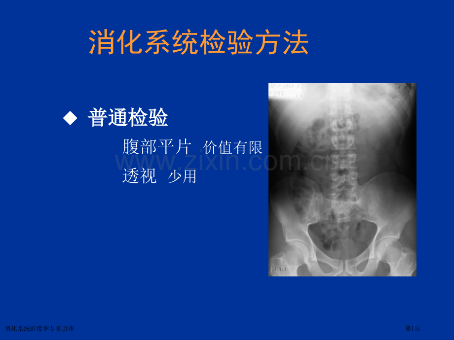 消化系统影像学专家讲座.pptx_第1页