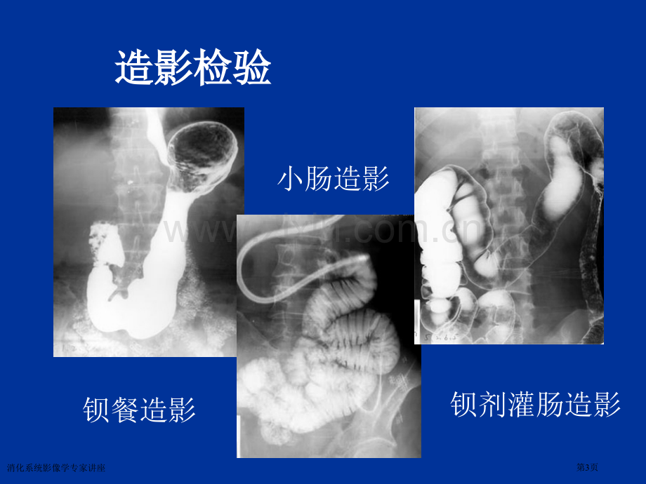 消化系统影像学专家讲座.pptx_第3页