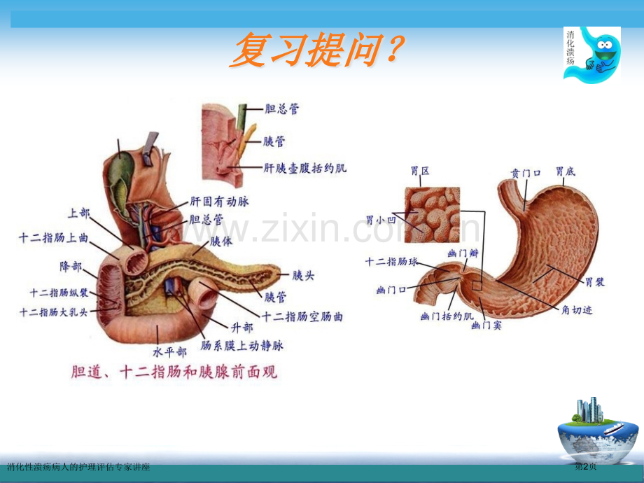 消化性溃疡病人的护理评估专家讲座.pptx_第2页