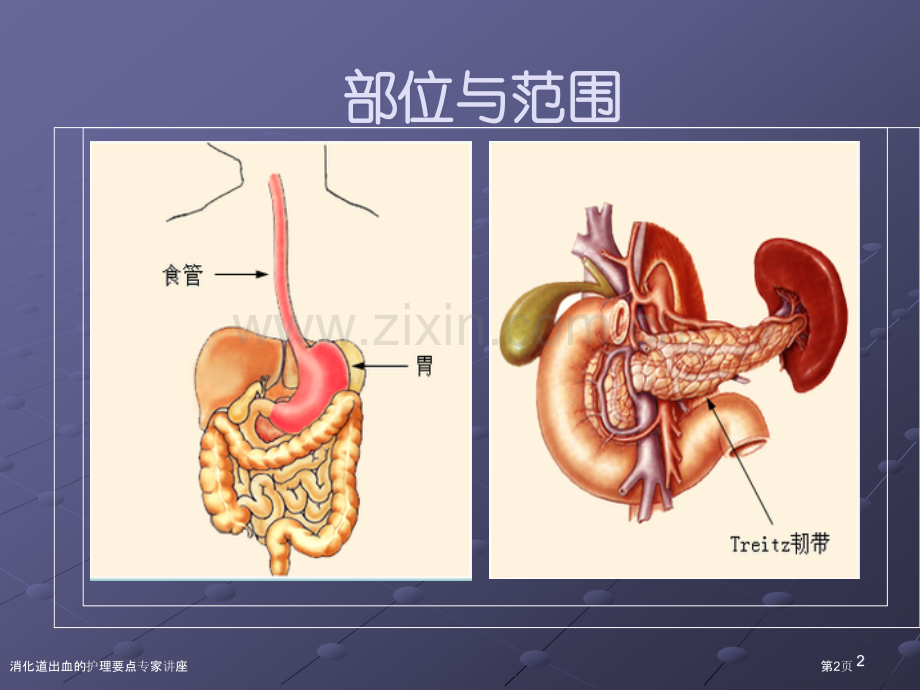 消化道出血的护理要点专家讲座.pptx_第2页