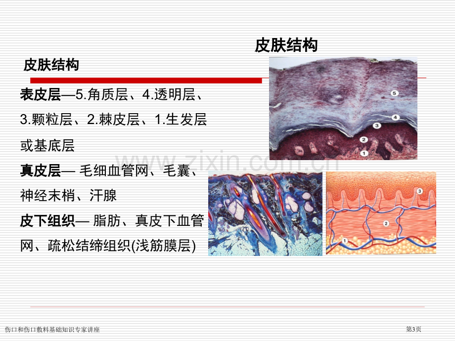 伤口和伤口敷料基础知识专家讲座.pptx_第3页