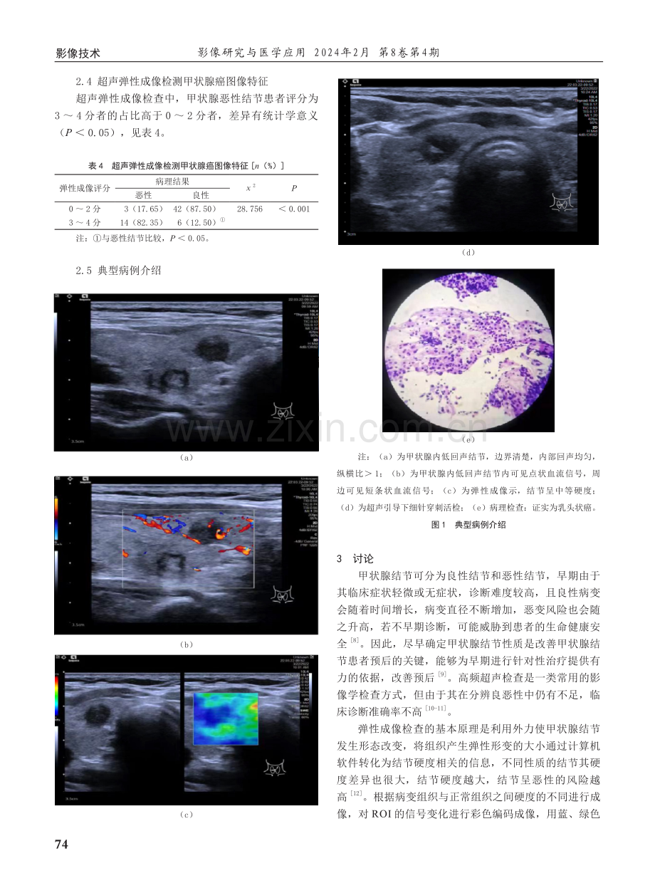 弹性成像与高频超声在甲状腺微小结节诊断中的价值.pdf_第3页