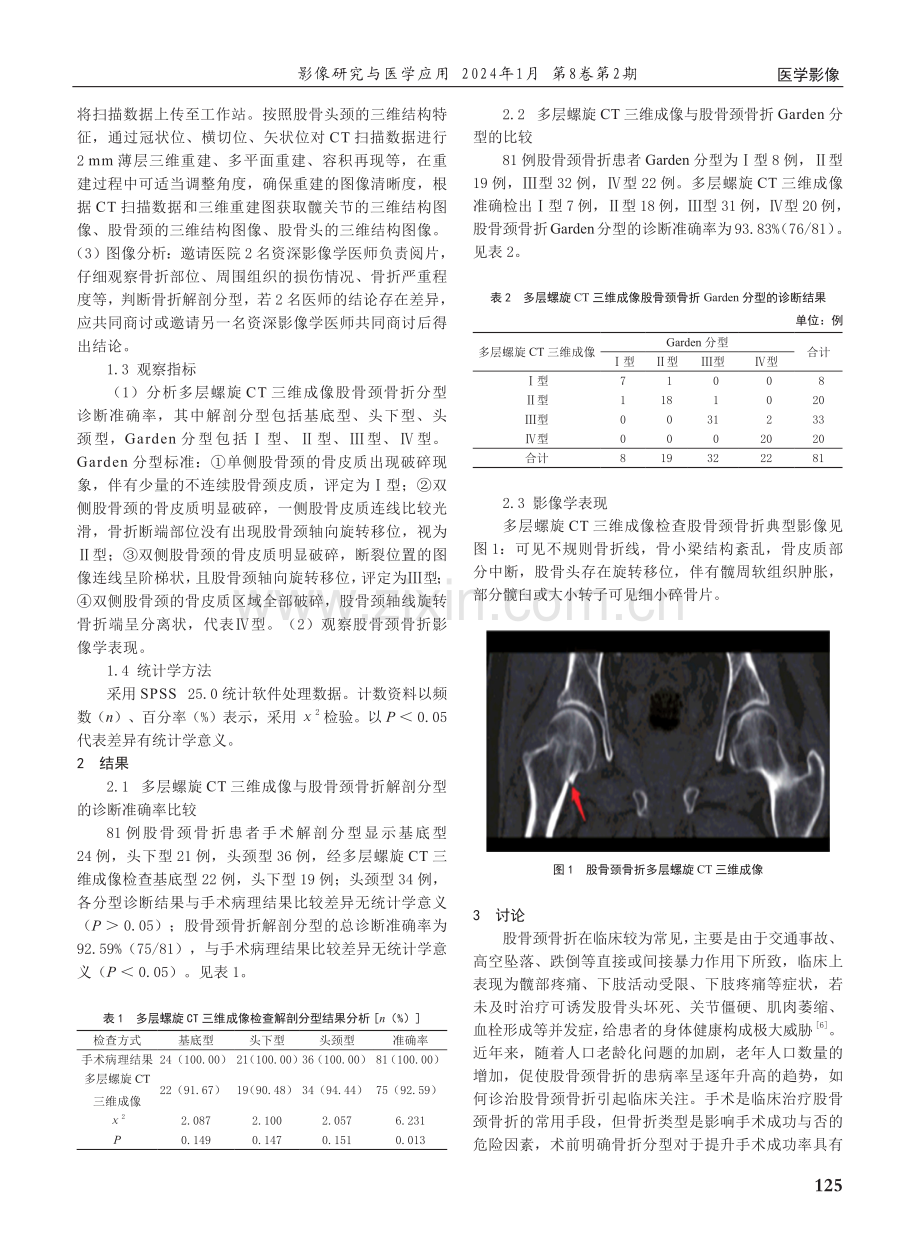 多层螺旋CT三维成像在股骨颈骨折分型鉴别诊断中的价值研究.pdf_第2页