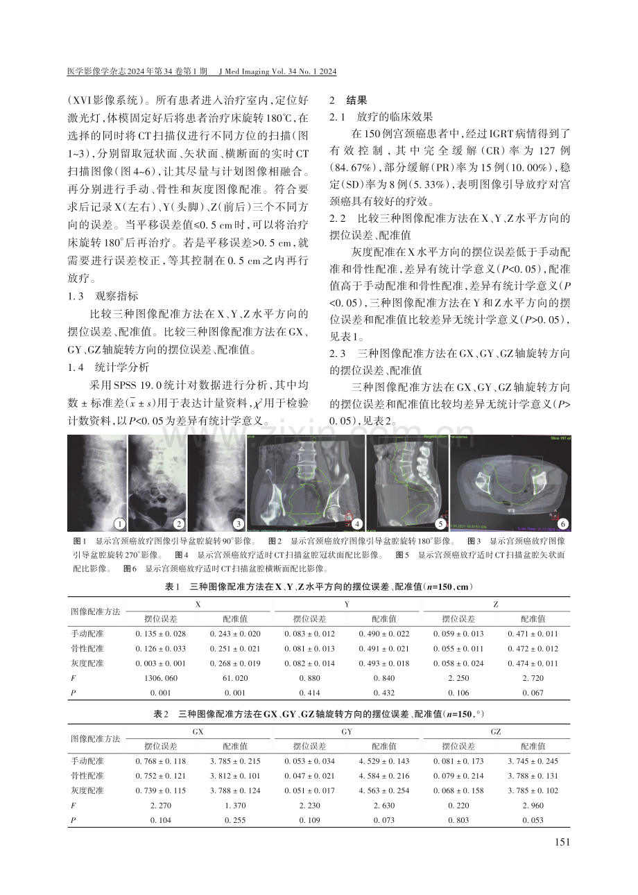 宫颈癌图像引导放疗技术在不同图像配准方法的应用价值.pdf_第2页