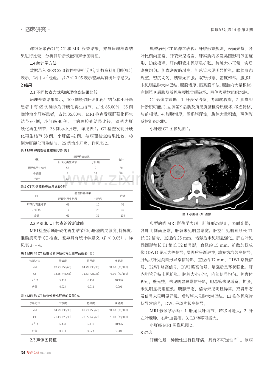 核磁共振和CT检查在肝硬化再生结节和小肝癌诊断中的效果分析.pdf_第2页