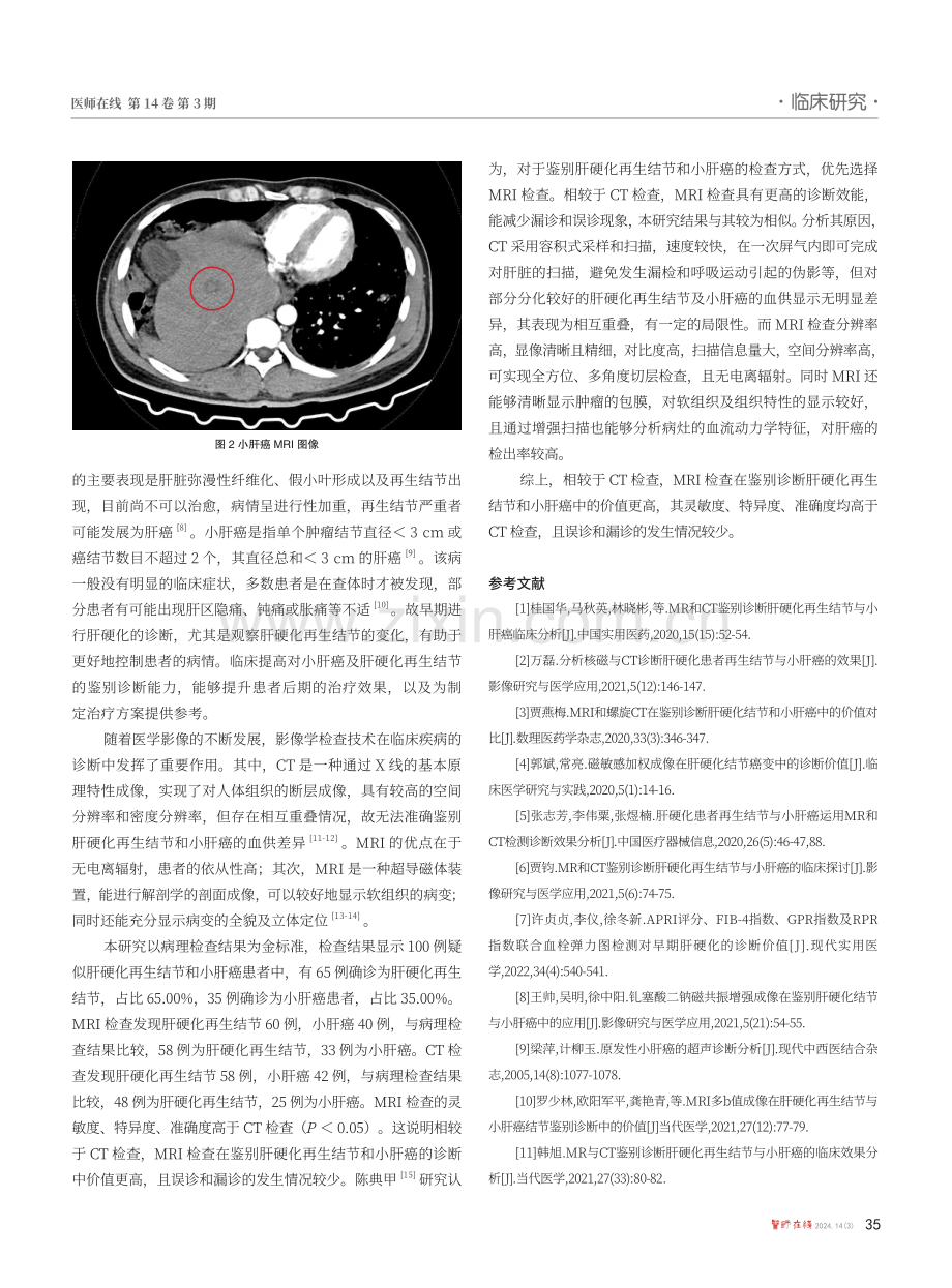 核磁共振和CT检查在肝硬化再生结节和小肝癌诊断中的效果分析.pdf_第3页