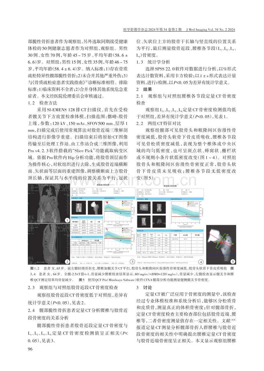 定量CT测量分析髋部脆性骨折患者腰椎与股骨近段骨密度的相关性.pdf_第2页