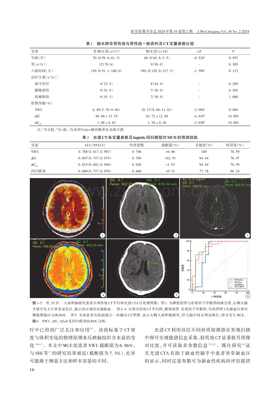 光谱CT在超急性期预测大面积脑梗死患者恶性脑水肿发生的价值.pdf_第3页