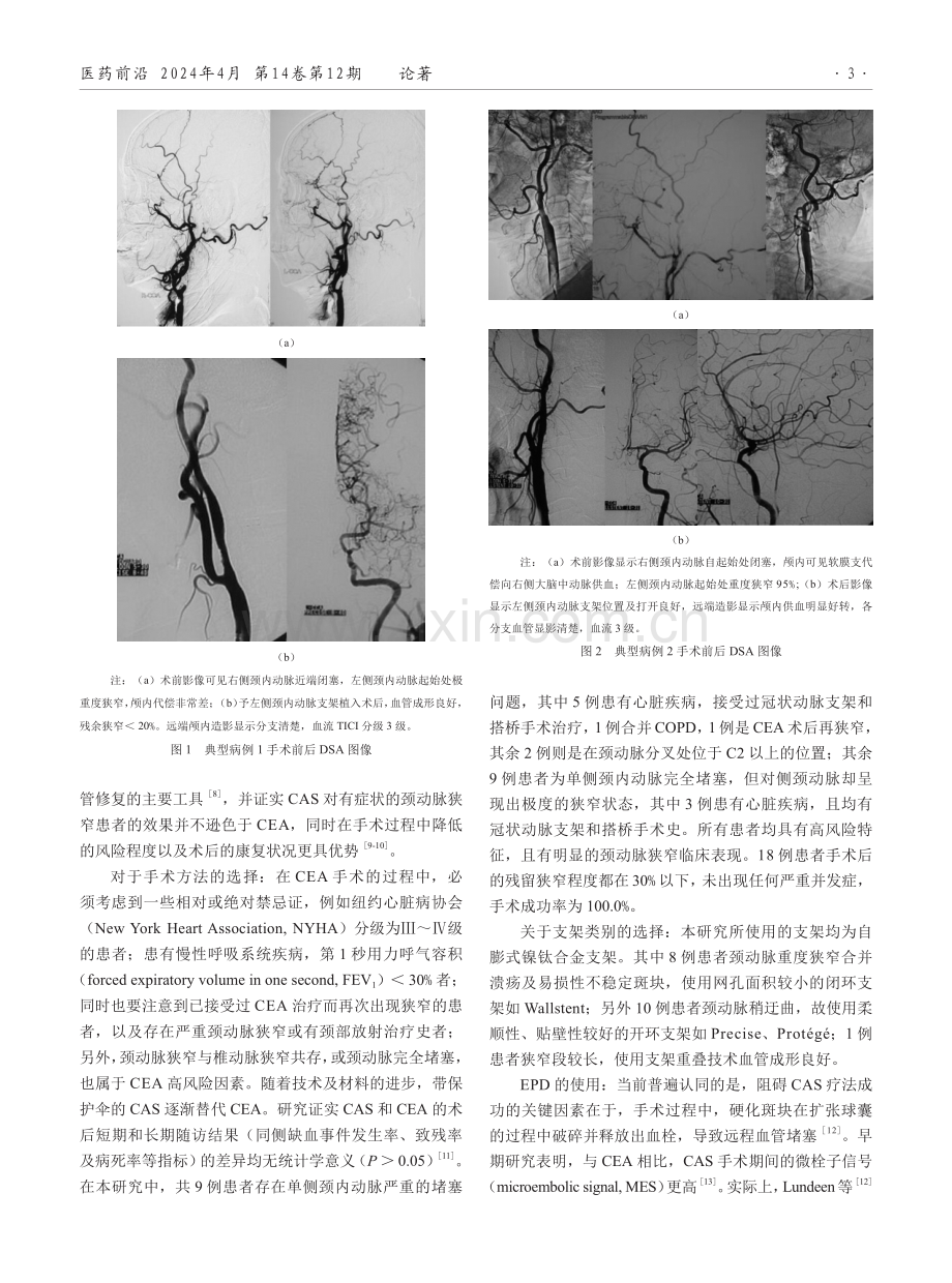 高危症状性颈动脉狭窄的介入治疗.pdf_第3页