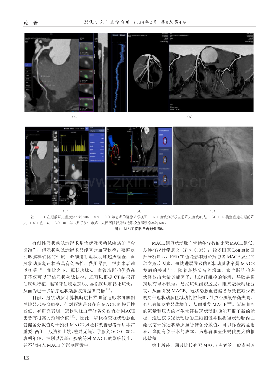 冠状动脉CT血管成像血管储备分数对冠心病不良心脏事件的预测价值分析.pdf_第3页